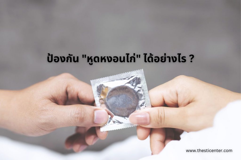 ป้องกัน "หูดหงอนไก่" ได้อย่างไร ?