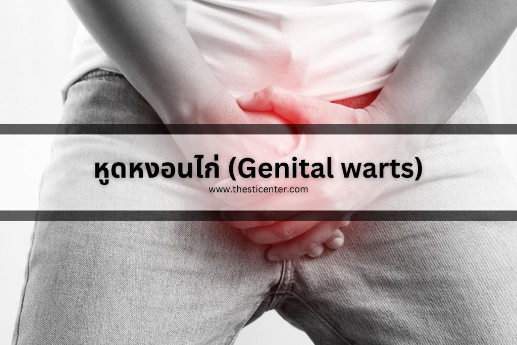 หูดหงอนไก่ (Genital warts)