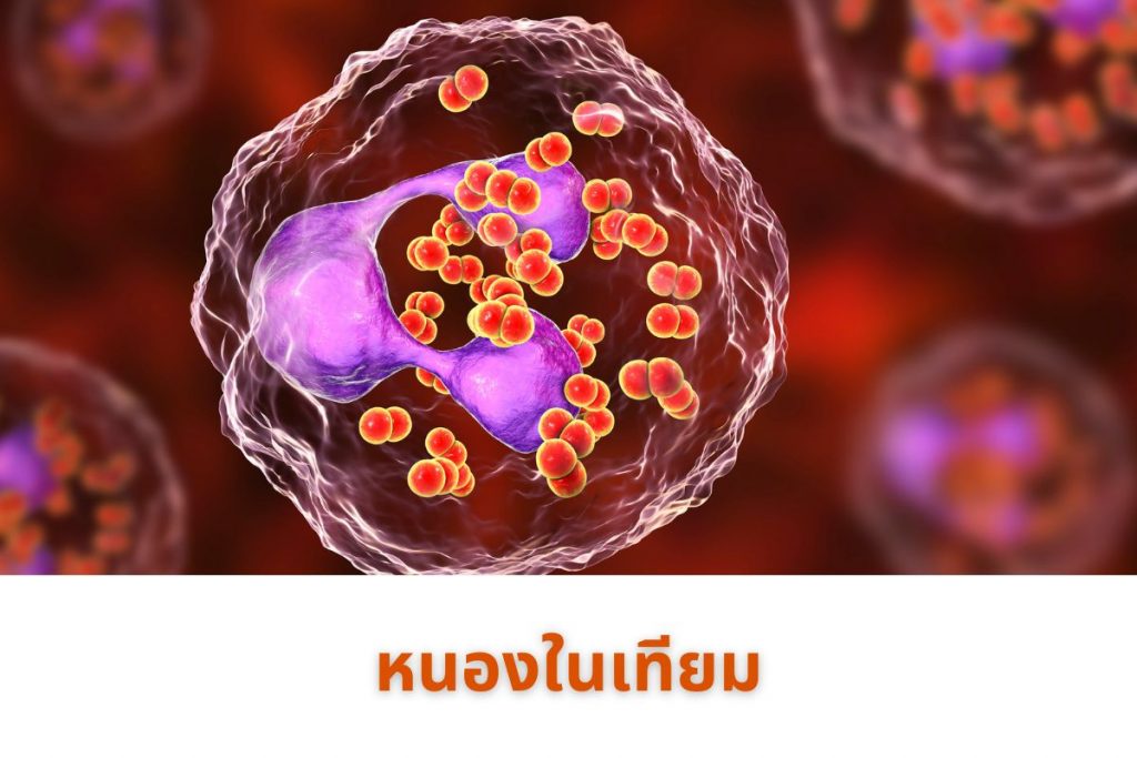 หนองในเทียม