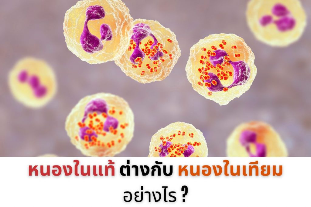 หนองในแท้ต่างกับหนองในเทียมอย่างไร?