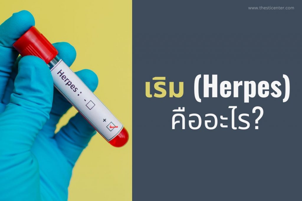 เริม (Herpes) คืออะไร?