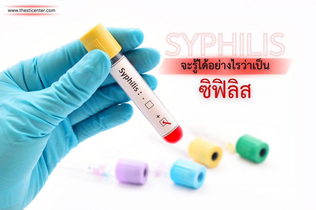 จะรู้ได้อย่างไรว่าเป็นซิฟิลิส ?