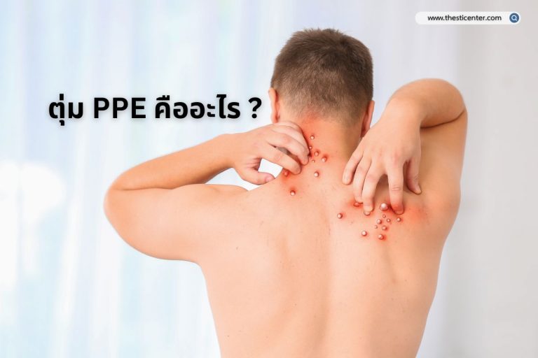 ตุ่ม PPE คืออะไร