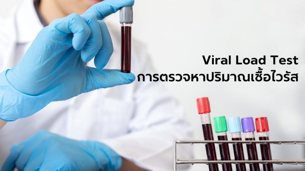Viral Load Test การตรวจหาปริมาณเชื้อไวรัส