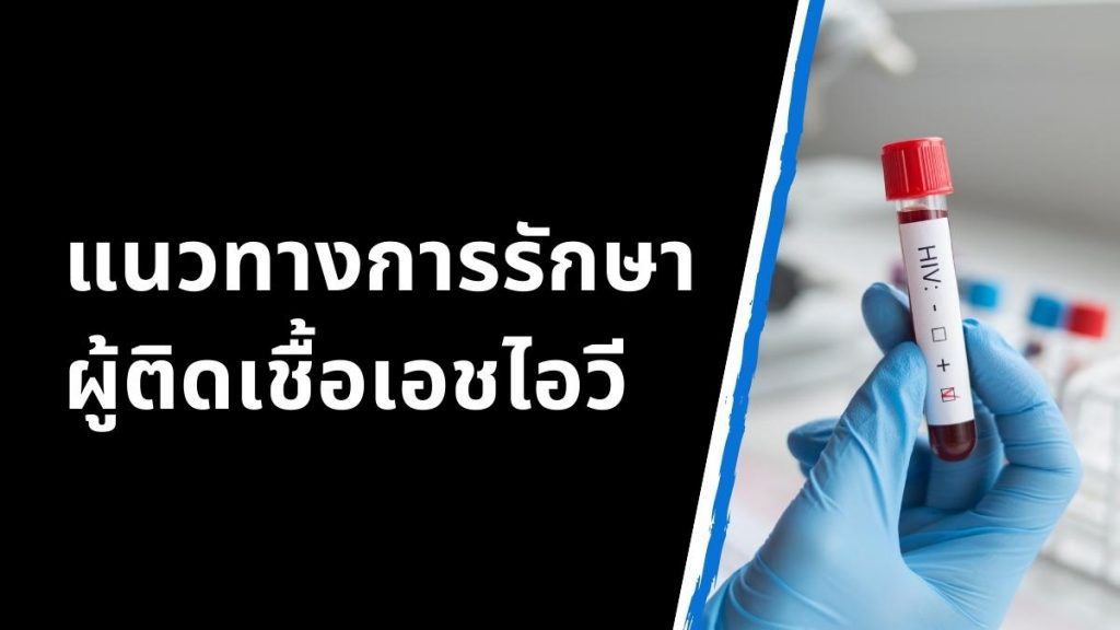 แนวทางการรักษาผู้ติดเชื้อเอชไอวี