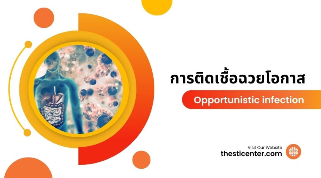 การติดเชื้อฉวยโอกาส Opportunistic infectionการติดเชื้อฉวยโอกาส Opportunistic infection