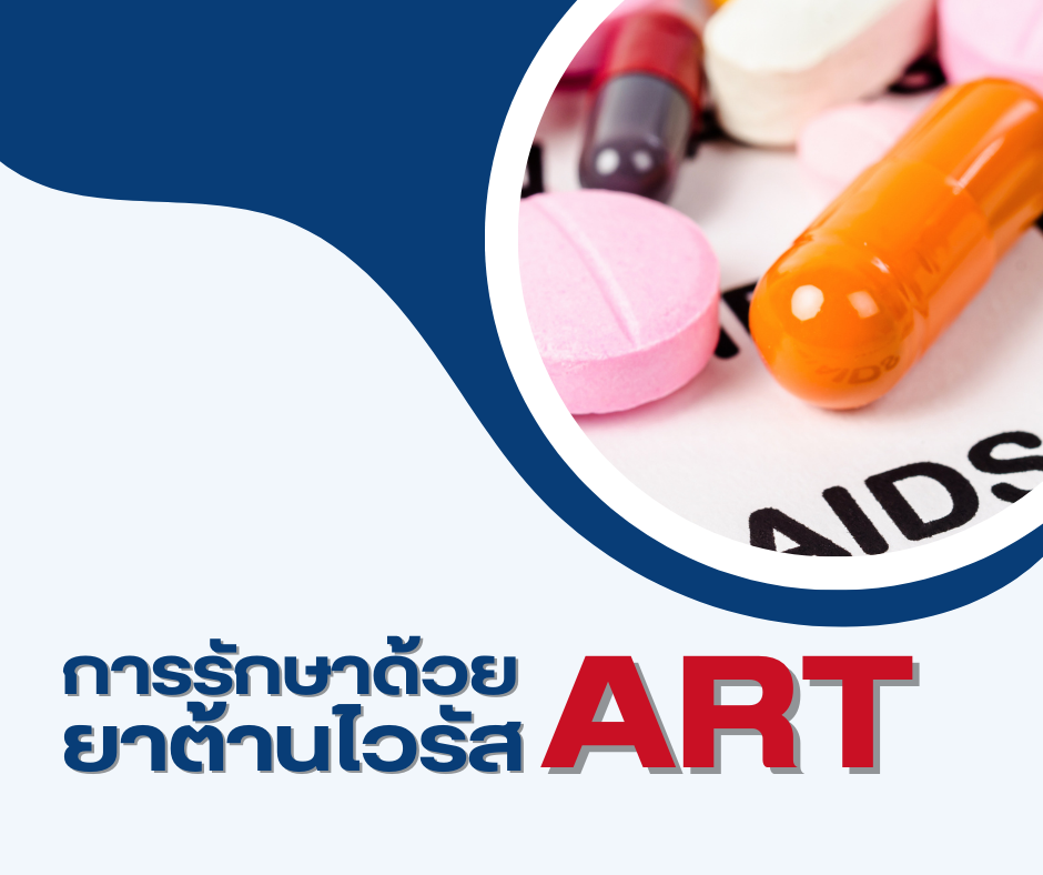 การรักษาด้วยยาต้านไวรัส ART