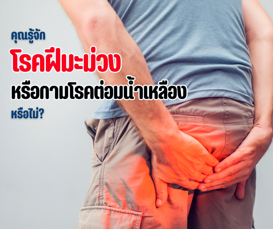 คุณรู้จักโรคฝีมะม่วง หรือกามโรคต่อมน้ำเหลือง หรือไม่