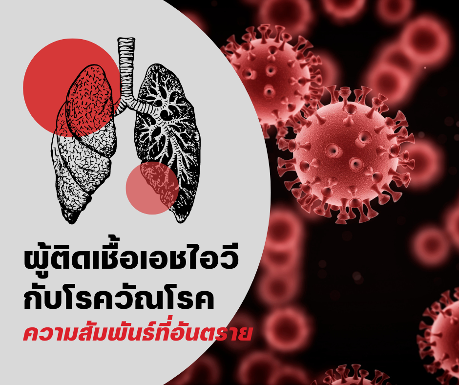 ผู้ติดเชื้อเอชไอวี กับโรควัณโรค ความสัมพันธ์ที่อันตราย
