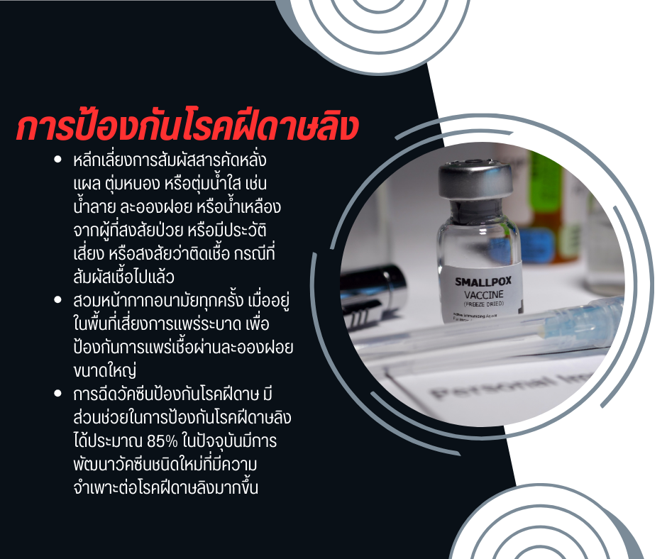 การป้องกันโรคฝีดาษลิง